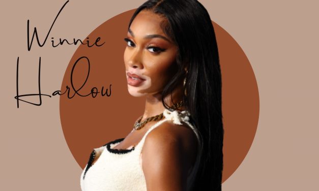 Nega kože lica Winnie Harlow: 3 sveta grala u borbi protiv akni