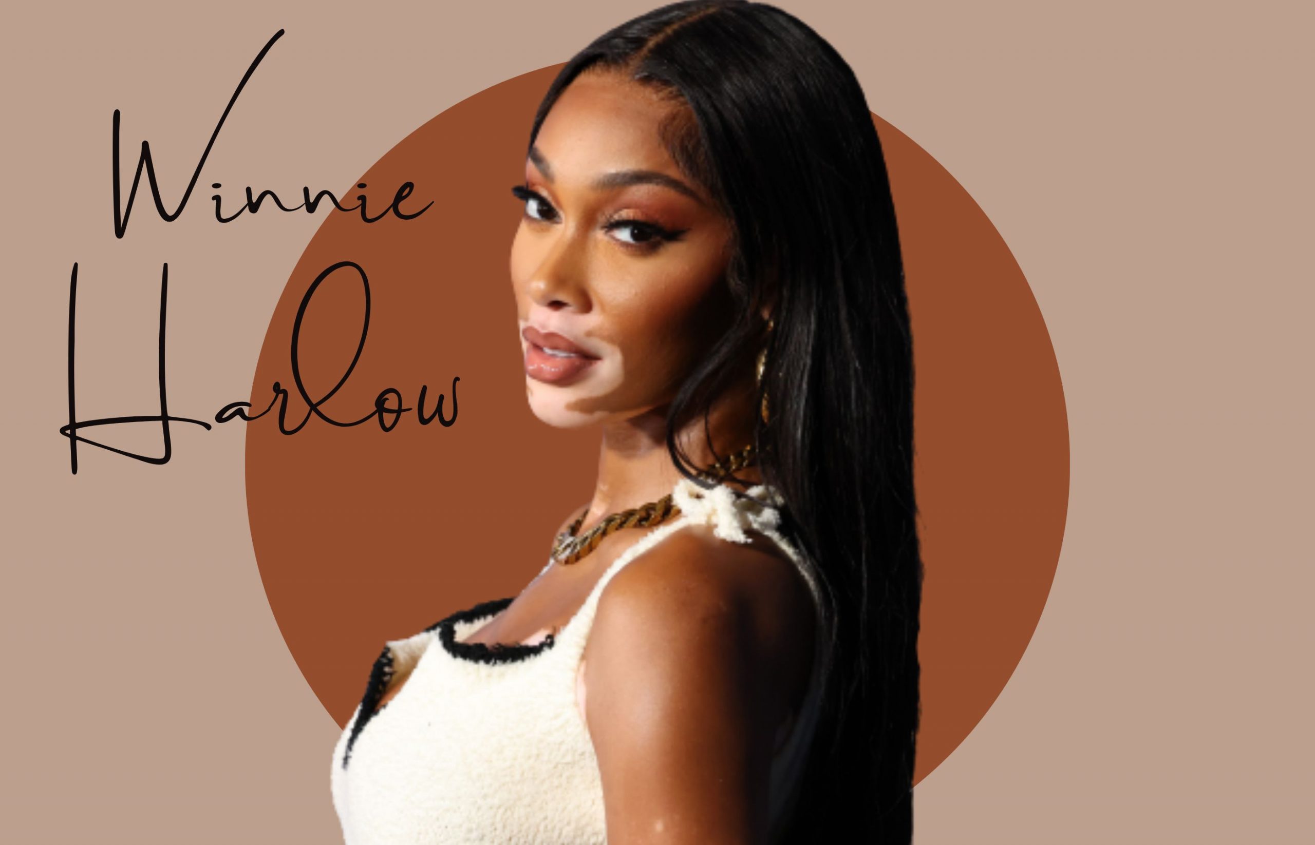 Nega kože lica Winnie Harlow: 3 sveta grala u borbi protiv akni