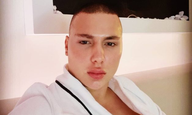 Brendon je danas izobličen od operacija, a DEVOJKE PLAČU KAD VIDE KAKAV JE FRAJER nekada bio! (FOTO)
