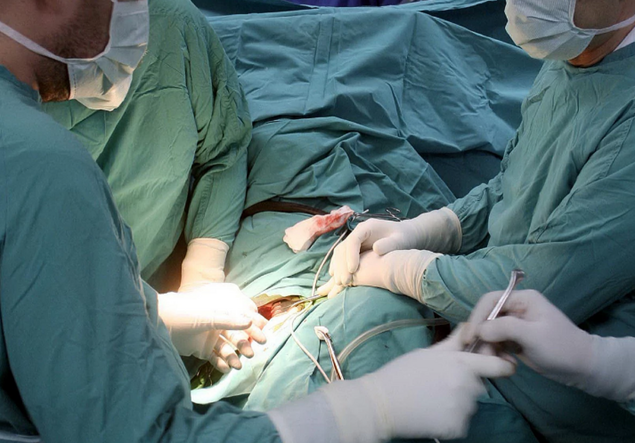 Luizijana bi mogla da bude prva država koja primenjuje hiruršku kastraciju
