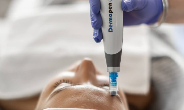 Zašto microneedling postaje standard u modernoj nezi kože