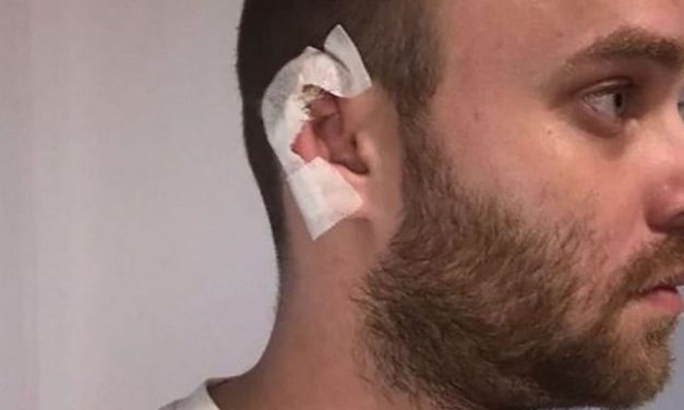 „Deo brade mi je otpao zbog stresa!“ Naš pevač o čoveku koji mu je odgrizao uvo, od tada zahteva obezbeđenje