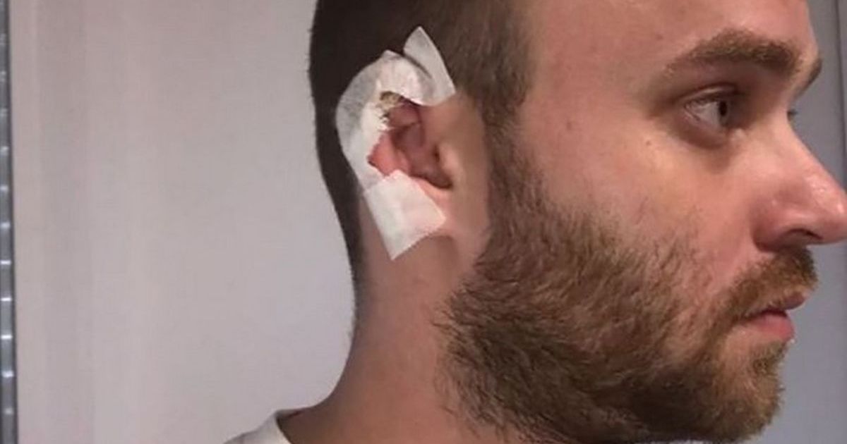 „Deo brade mi je otpao zbog stresa!“ Naš pevač o čoveku koji mu je odgrizao uvo, od tada zahteva obezbeđenje