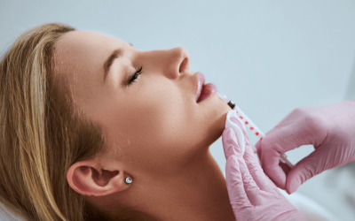 Fileri za usne – između mita i stvarnosti savremene estetike