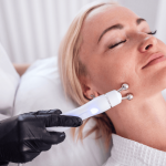 Umoran ten, sitne nepravilnosti i tragovi nakon akni: kada hemijski piling za lice ima najviše smisla